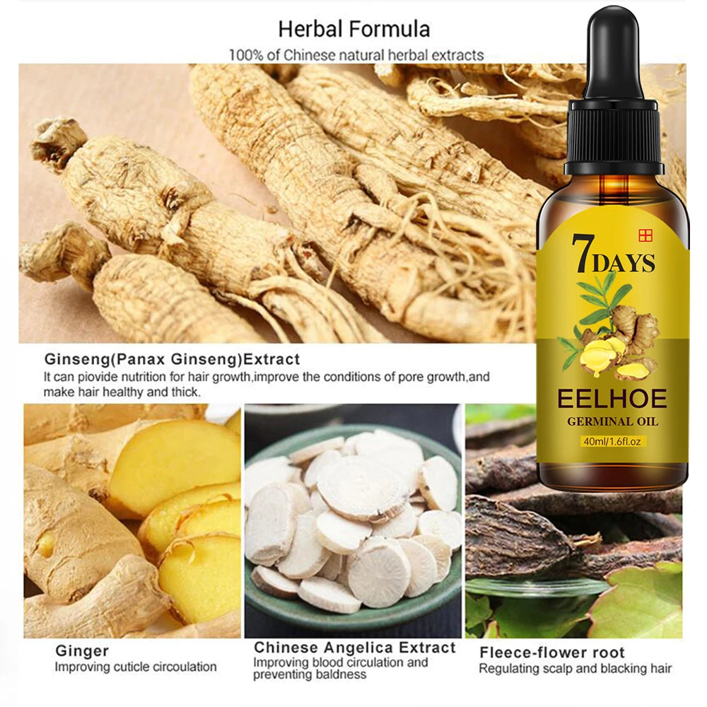 EELHOE™ Ginger Hair Oil - OptiWellLife