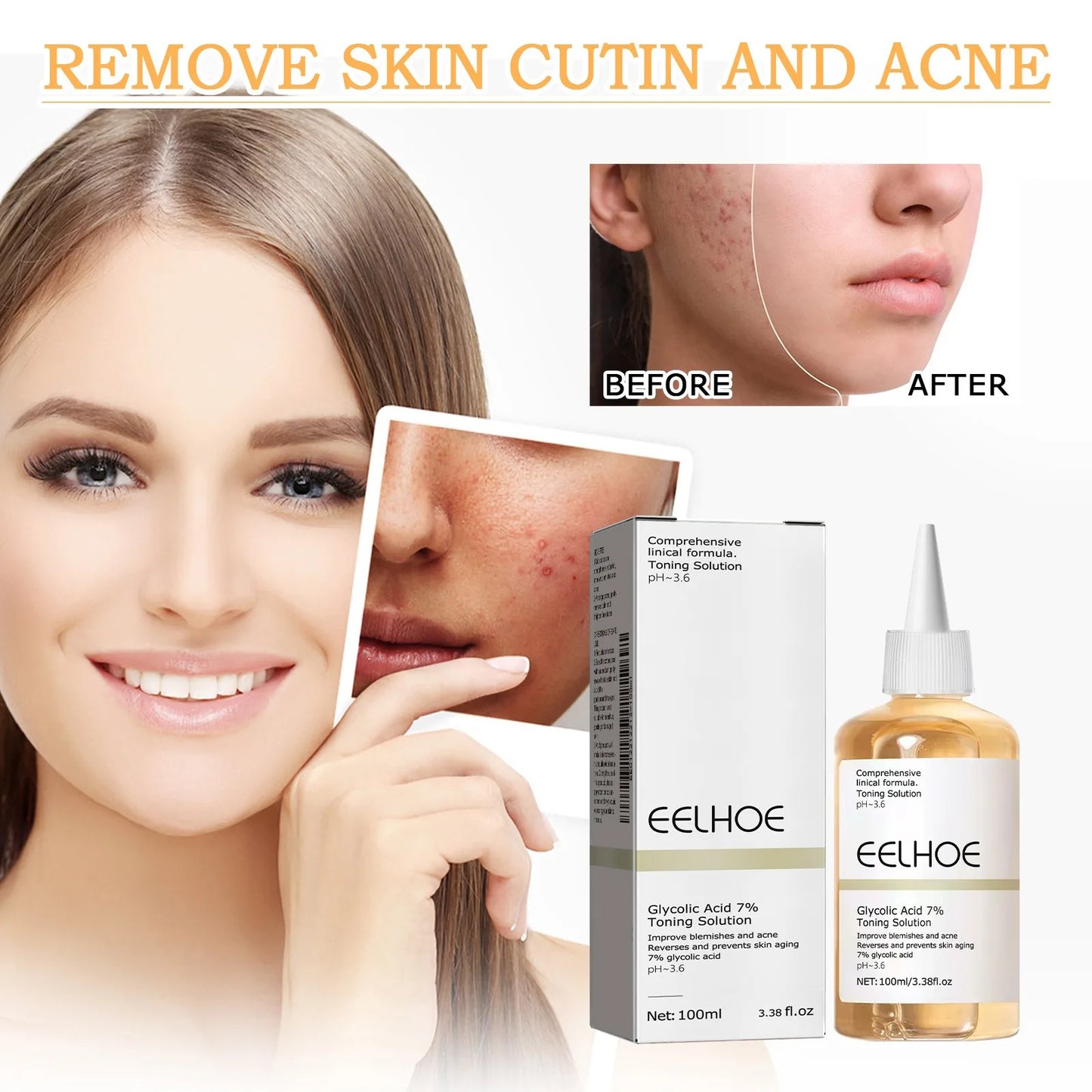 EELHOE™ Glycolic Acid 7% Toning Solution - OptiWellLife