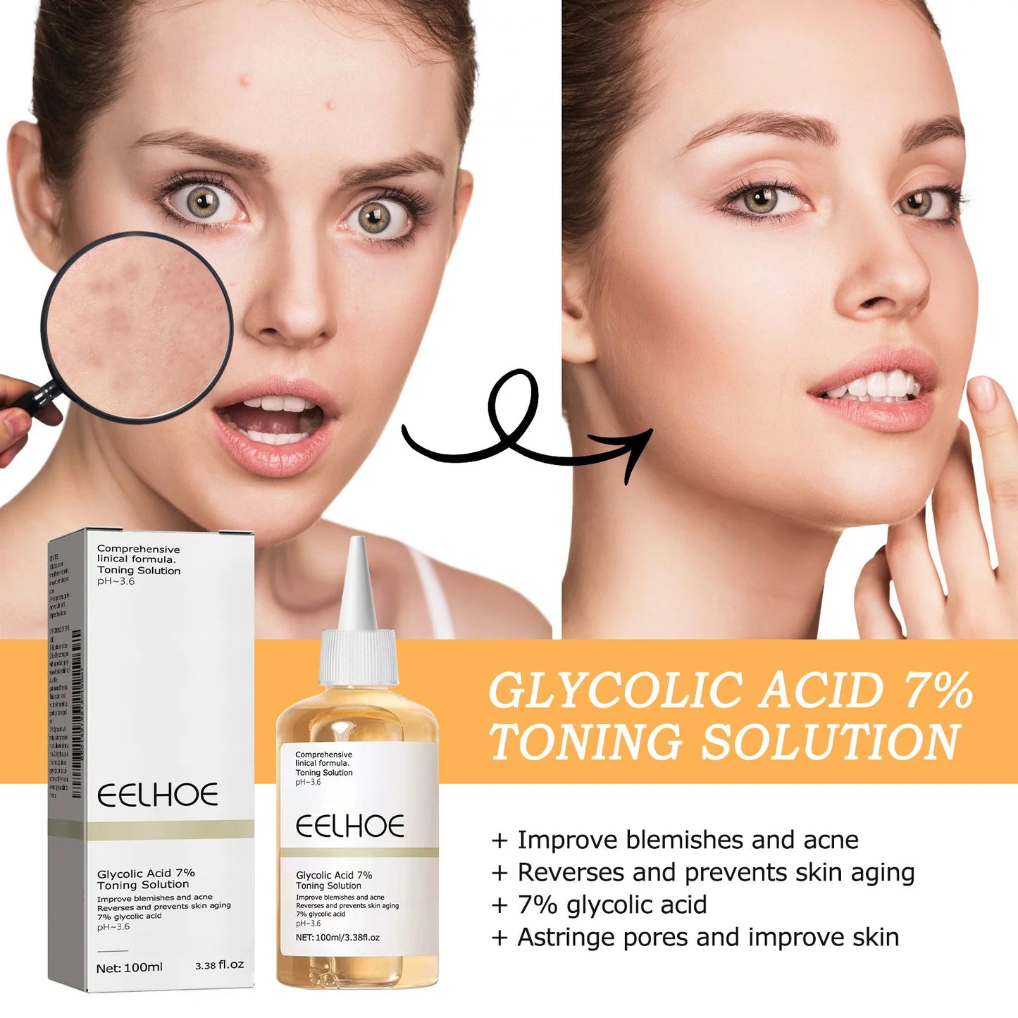 EELHOE™ Glycolic Acid 7% Toning Solution - OptiWellLife